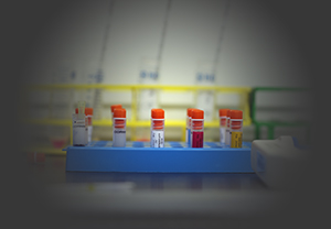 55th Congres of the European Societies of Toxicology