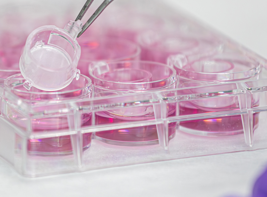 SkinEthic Human Bladder Epithelium HBE