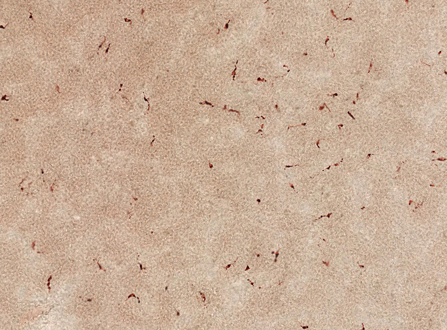 SkinEthic Reconstructed Human Epidermis with Langerhans Cells