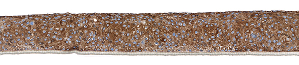 SkinEthic HBE Keratin 17