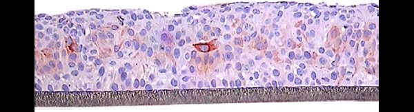 SkinEthic HO2E Keratin 6