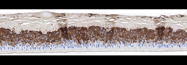 SkinEthic RHE Keratin 10