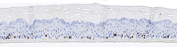 SkinEthic RHE ACF KI67