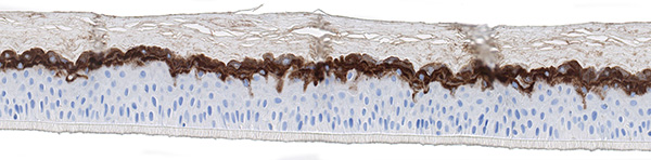 SkinEthic RHE ACF Loricrin