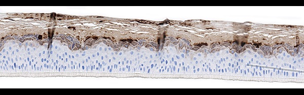 SkinEthic RHE Filaggrin